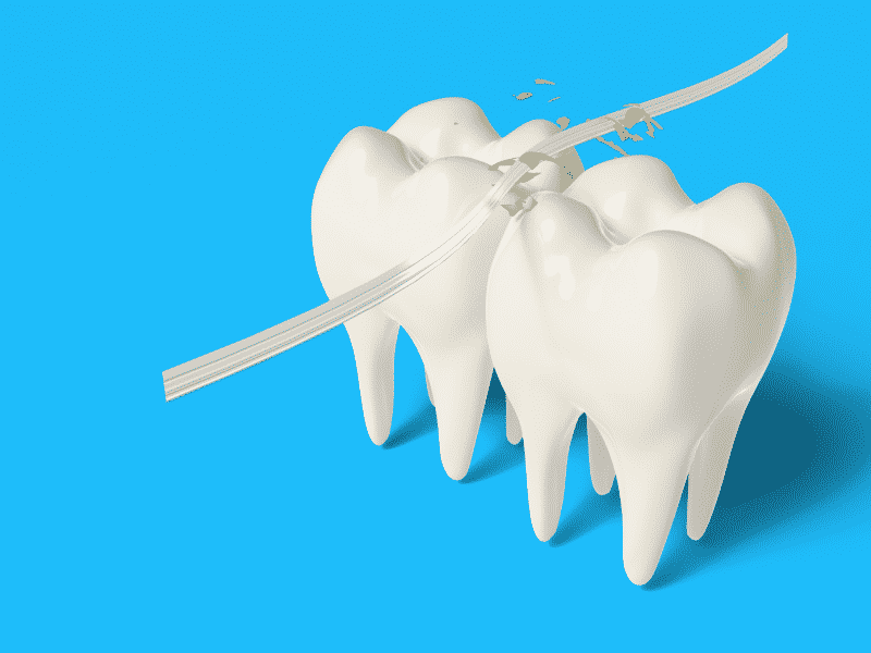 The Importance of Flossing