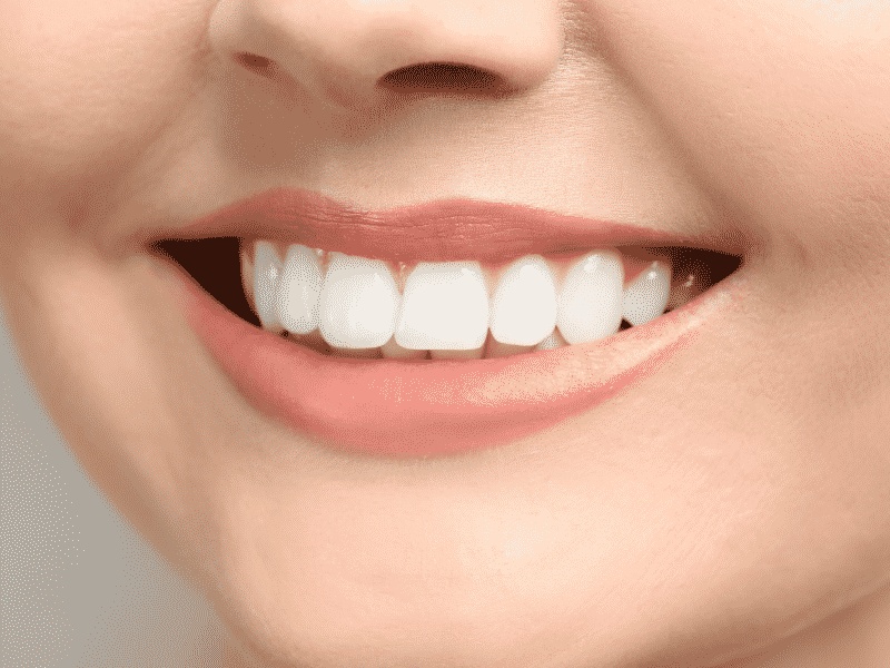 teeth whitening walnut grove langley