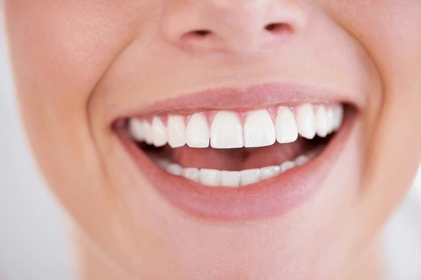 cosmetic dentistry in walnut grove, bc