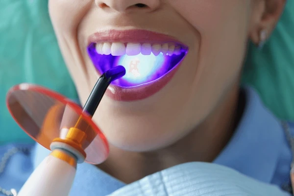 laser dentistry in walnut grove, bc