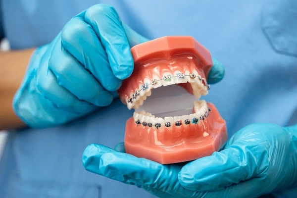 orthodontics near you