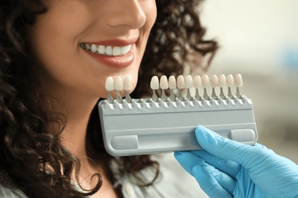 porcelain veneers in walnut grove, bc