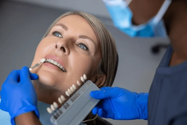 porcelain veneers near you