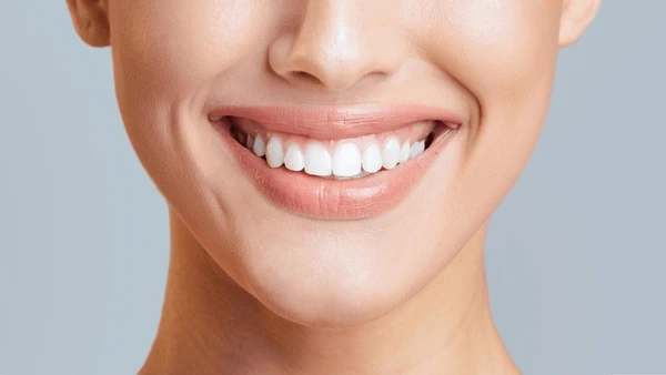 teeth whitening in walnut grove, bc