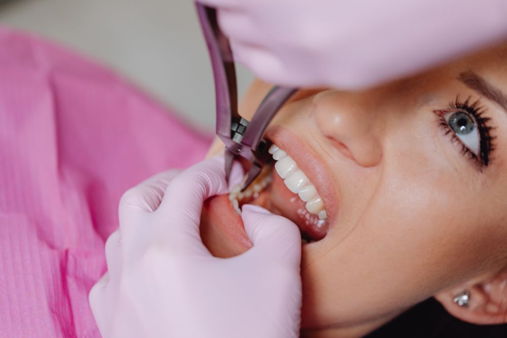 foods after wisdom teeth removal