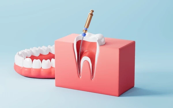 root-canal-treatment-01